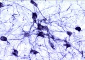 TH | Tyrosine Hydroxylase in the group Antibodies Human Cell Biology / Neuroscience / Neurobiology at Agrisera AB (Antibodies for research) (AS13 2696)